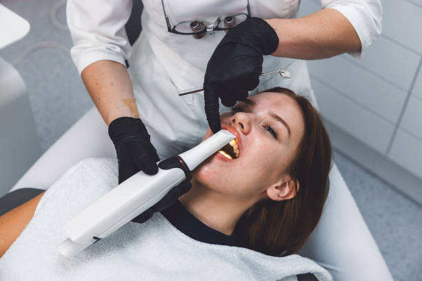 Best Teeth Whitening  in Peru, IN